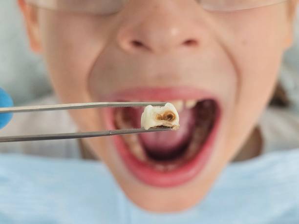 Best Walk-In Emergency Dentist in Twin Grove, IL